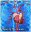 Patsientide tuvastamine ja ravi, kellel on kõrge südame rütmihäirete oht modifitseeritud südamehaiguste ravi ajal