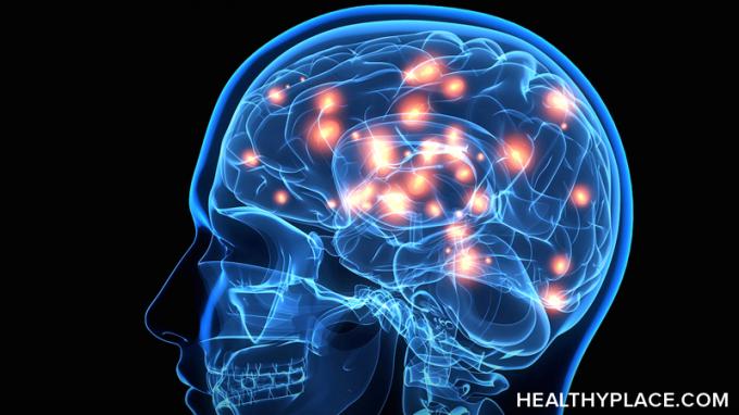 Kuidas on Parkinsoni tõve aju erinev? Siit saate HealthyPlace'i kohta teada, kuidas Parkinsoni aju mõjutab ja mida aju skaneerimine näitab. 