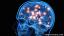 Kuidas mõjutab Parkinsoni tõbi aju