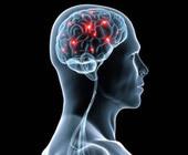 Vaimuhaigus võib teie aju üle stimuleerida